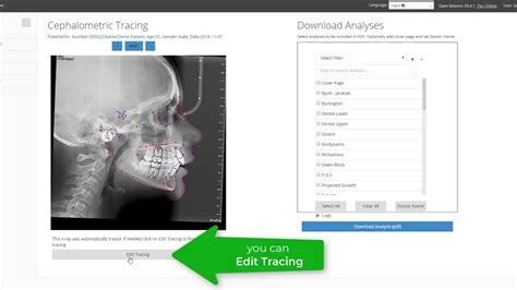 Cephx Uploading New Cephalometric X Ray For Tracing And Analysis Youtube