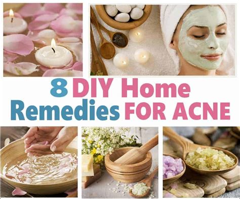 Diy Home Remedies For Acne Blemishes And Pimples