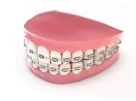 Fake Teeth Set With Braces Digital Art By Allan Swart Pixels