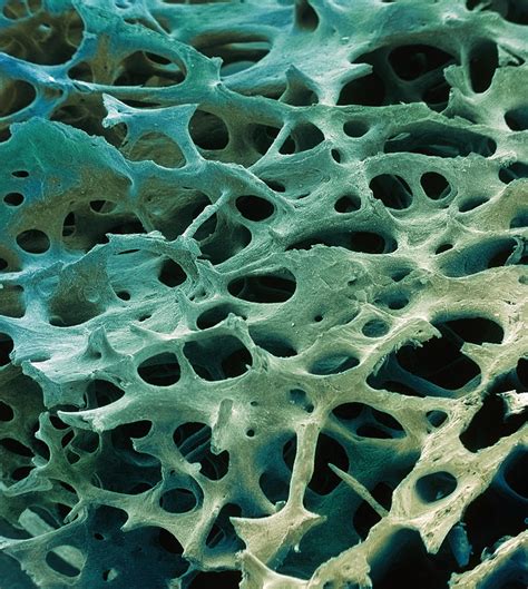 Spongy Bone Sem Photograph By Steve Gschmeissner Pixels