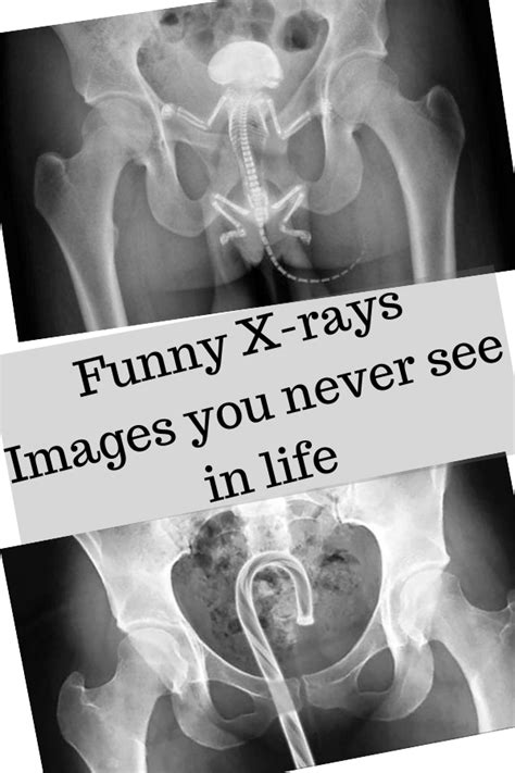 X Ray Jokes Pictures Perpustakaan Sekolah