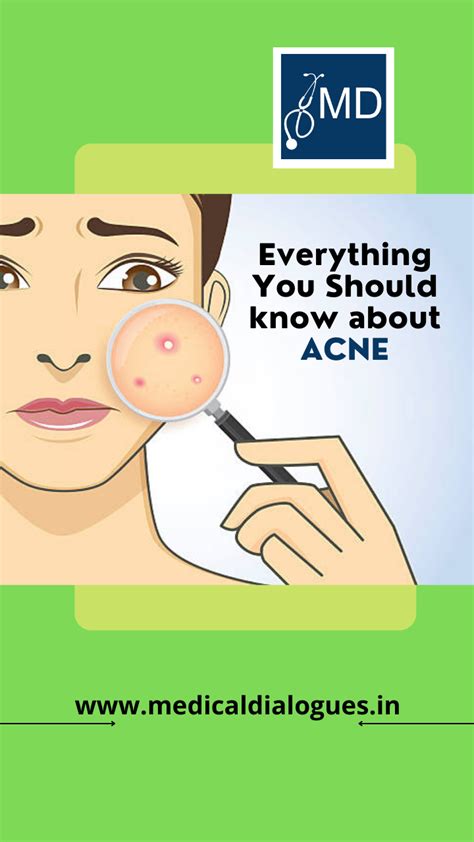 Everything You Should Know About Acne