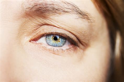 Drooping Eyelids Can Affect Your Vision Sight Eye Clinic Explains