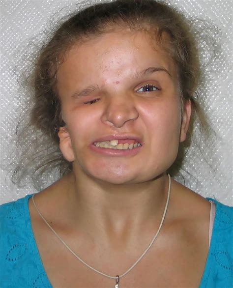 Deformed Girl Goes Under The Knife So Her Mom Would Love Her And Dies As A Result You