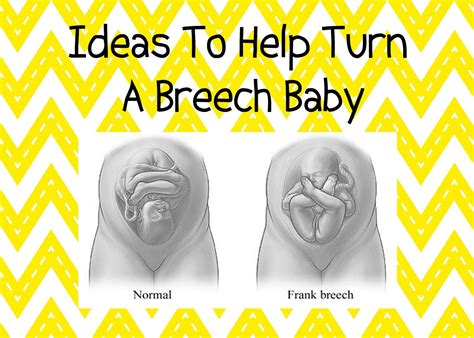My Own Imperfect Perfection Ideas To Help Turn A Breech Baby Breech