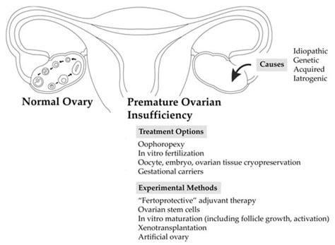 Biomedicines Free Full Text Premature Ovarian Insufficiency
