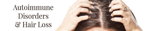Autoimmune Related Hair Loss