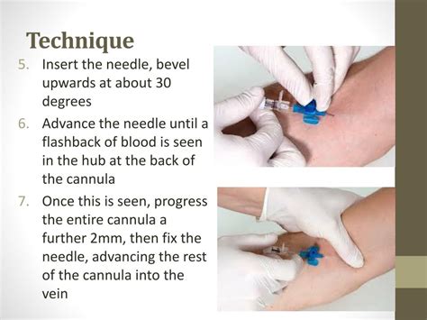 Ppt Intravenous Cannulation Powerpoint Presentation