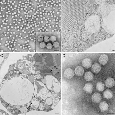 Electron Microscopy Of Purified Viral Particles And Infected Mosquito