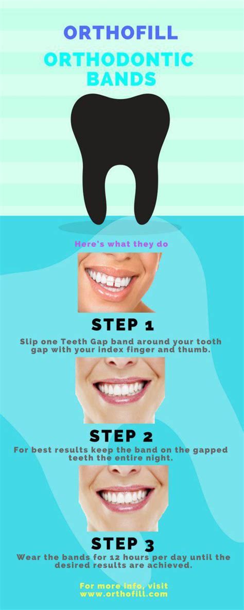 Teeth gap bands to correct gap teeth are just one of the many popular new diy fixes. Have your Teeth Gap Fix with just 3 Easy and Simple Steps ...