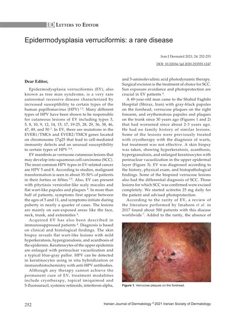 Pdf Epidermodysplasia Verruciformis A Rare Disease