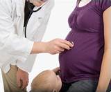 Images of Eclampsia Mayo Clinic