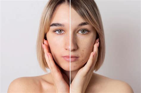 Improve Uneven Skin Tone By Doing These 5 Things Nashé Beauty