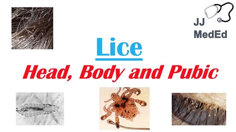 Lice Head Body And Pubic Lice Pediculosis Species Symptoms And