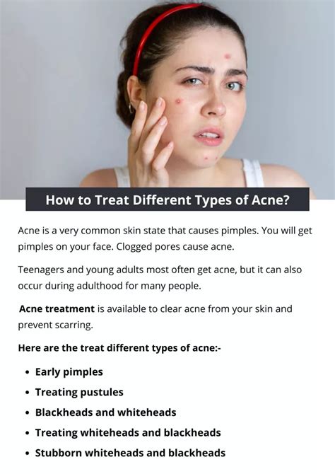Ppt How To Treat Different Types Of Acne Powerpoint Presentation