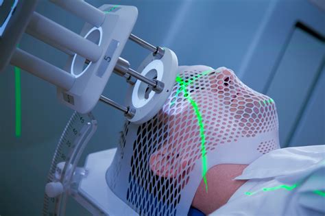 Radiation Therapy An Option For Brain Tumor Surgery ~ Medical Tourism