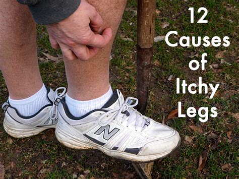 Is Itchy Feet A Sign Of Diabetes