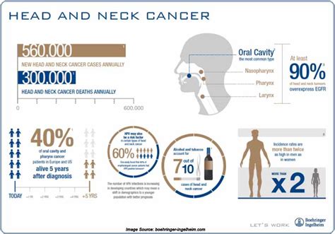 Head And Neck Cancers Causes Symptoms Diagnosis Treatment And More