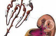 Диета хронический гломерулонефрит Хронический гломерулонефрит: место в мкб, клинические рекомендации Хронический гломерулонефрит: место в мкб, клинические рекомендации Диета хронический гломерулонефрит