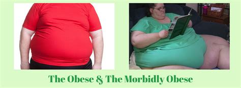 obesity and morbid obesity dr m maran springfield wellness centre