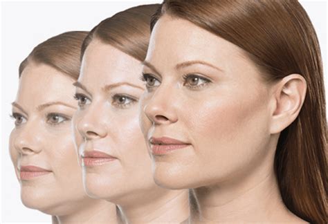 Double Chin Treatment Is It Right For You Z Cosmetic Health Blog