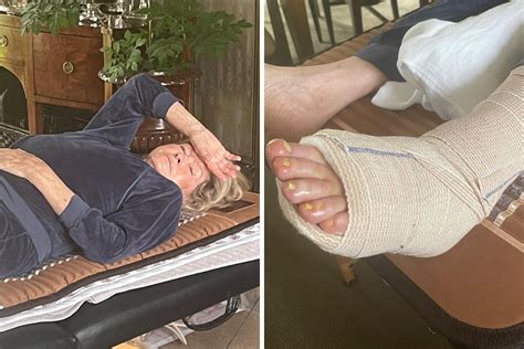Martha Stewart Recovering From 3 Hour Surgery On Achilles Tendon Injury