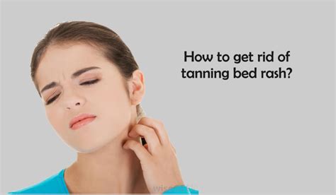 How To Get Rid Of Tanning Bed Rash Fast In 7 Days Only