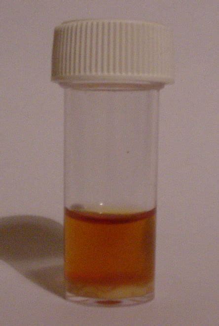 ▶ acquired a patent for sensor technology. Urinalysis: centrifuged deposit lab test | rabbits ...