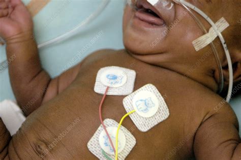 It is very relaxing and calming for the baby. Premature baby monitoring - Stock Image - M820/0566 ...