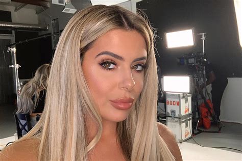 Brielle Biermann S Jaw Surgery Plastic Surgery Talks