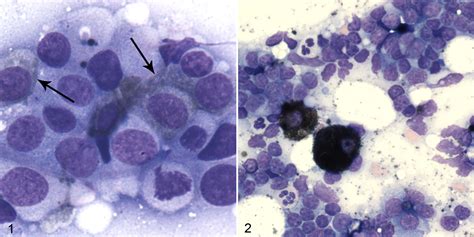 Agreement Between Cytology And Histopathology For Regional Lymph Node
