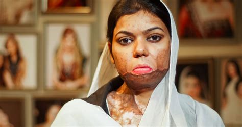 All beauty parlours in the province will be registered and given the status of an industry while women working there will be imparted training to the minister said that presently approximately 25 million people had been affected by hepatitis b and c in pakistan which was very alarming. Beauty Salon Helps Acid Attack Survivors In Pakistan To Be ...