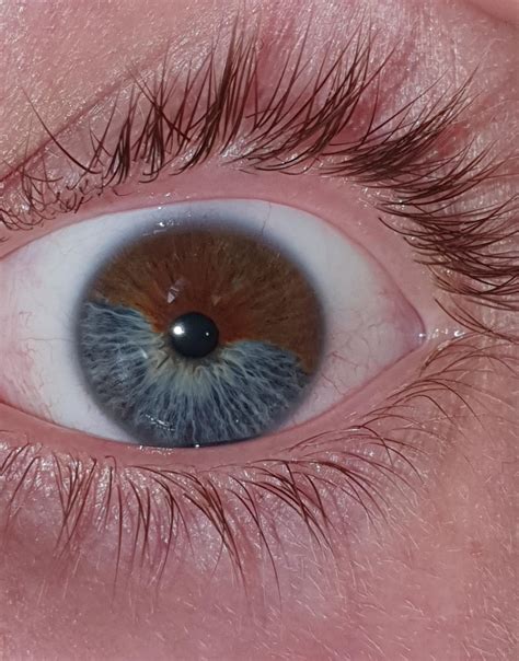 My eye has 2 different colors : mildlyinteresting