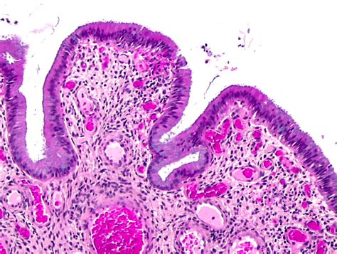 Histopathology Of The Uterine Cervix Digital Atlas