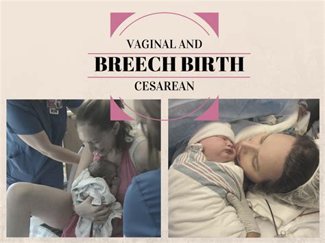 Vaginal Vs Cesarean Breech Birth Better Birth Blog