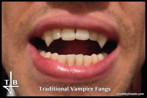 Traditional Vampire Teeth By Dnash