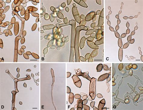 Cladosporium A Common Mold Spore Mold Awareness