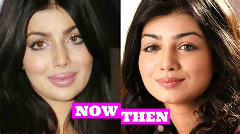 Ayesha Takia Plastic Surgery Gone Wrong Before And After Youtube
