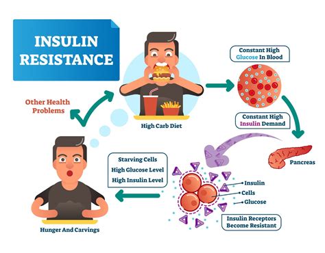 Everything You Need To Know About Insulin Resistance