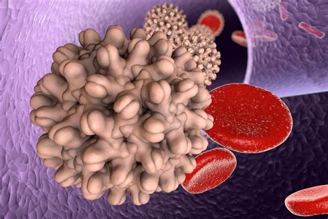 Management of chronic hepatitis b: Hepatitis B Symptoms, Treatment, Causes, What is Hepatitis B