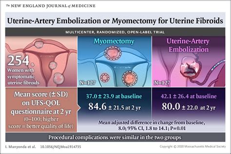 Fibroids And Pregnancy Archives Houston Fibroids