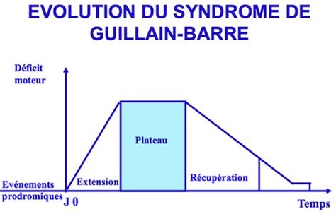 Le syndrome de Guillain Barré SGB Récap IDE