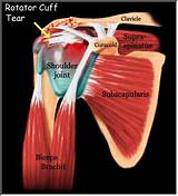 Deltoid Strain Recovery Time Photos