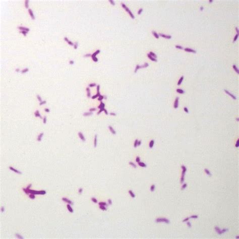 Gram Negative Bacillus Slide Wm Gram Stain Science Lab Microbiology