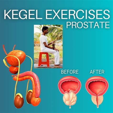 Kegel Exercises Yoga With Amit For Enlarged Prostate