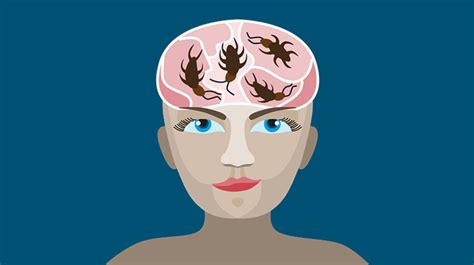 【閲覧注意】女性の頭部に入り込んだ「生きたゴキブリ」摘出される ギズモード・ジャパン