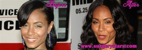 Jada Pinkett Smith Plastic Surgery Before And After Pic