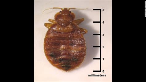 Bedbug Pictures Bites Signs And Symptoms