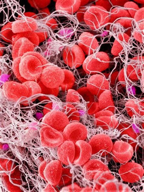 Blood Clot Sem Stock Image C0097815 Science Photo Library