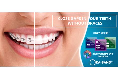 Watch the video explanation about how to close gaps between teeth without braces fast? How To Fix Gaps In Your Teeth Without Braces - TeethWalls